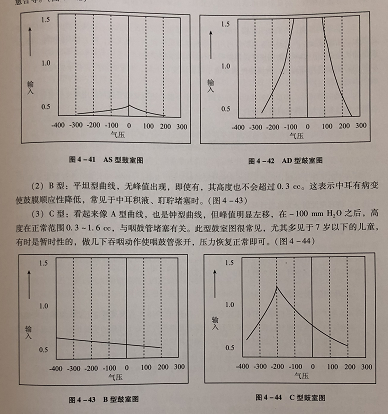 关于声导抗普通人应该怎么看