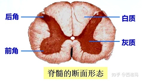 新冠,猴痘之后,纽约城市废水中又检出脊髓灰质炎病毒,目前当地情况