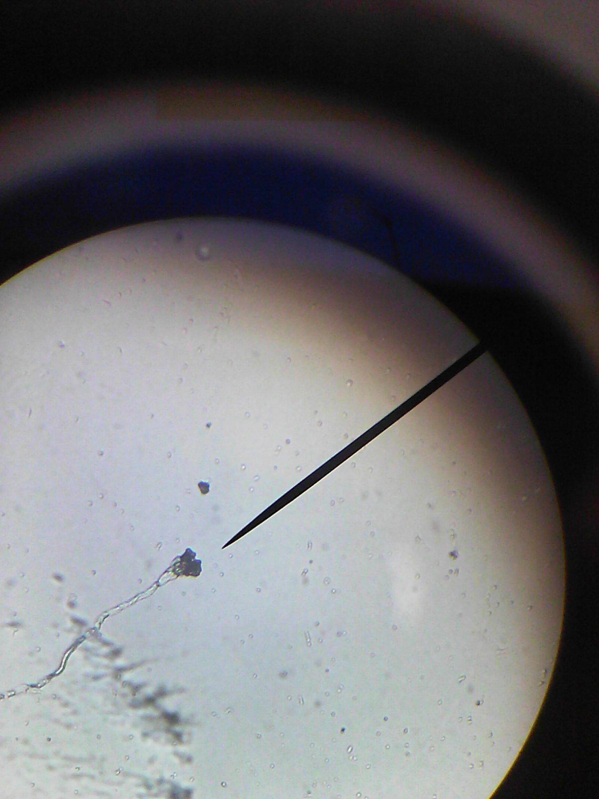 如何在显微镜下观察霉菌