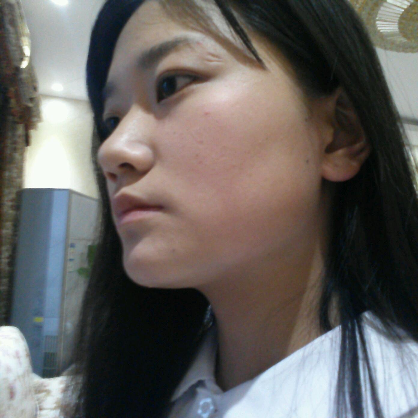 下颌骨有点宽的女生怎么办