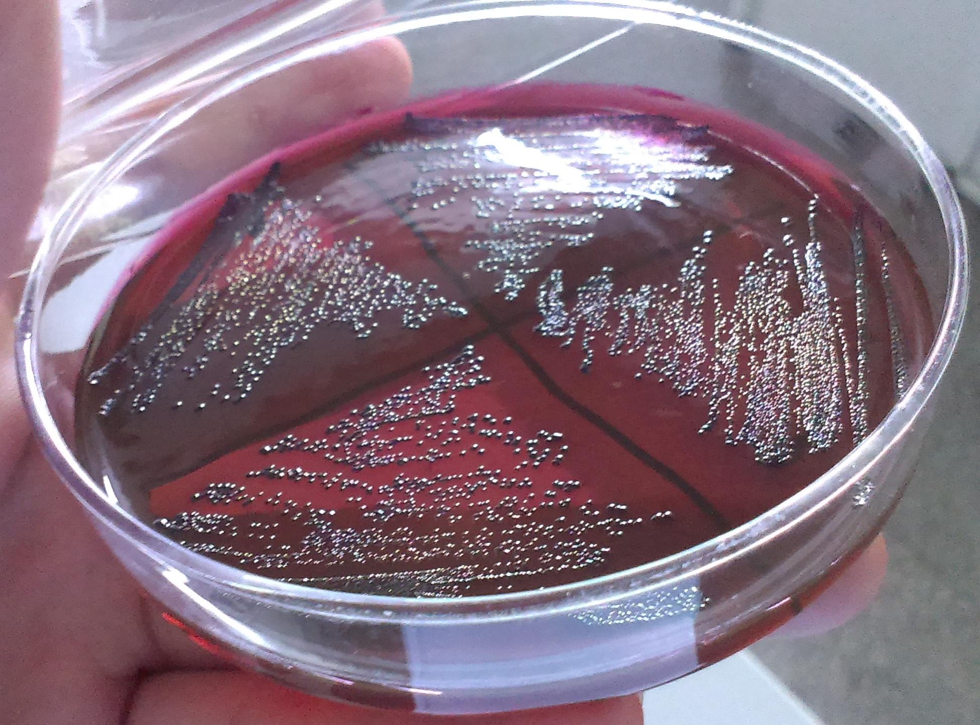 细菌都是什么颜色的?一种细菌长在不同的营养物质上颜色一样吗?