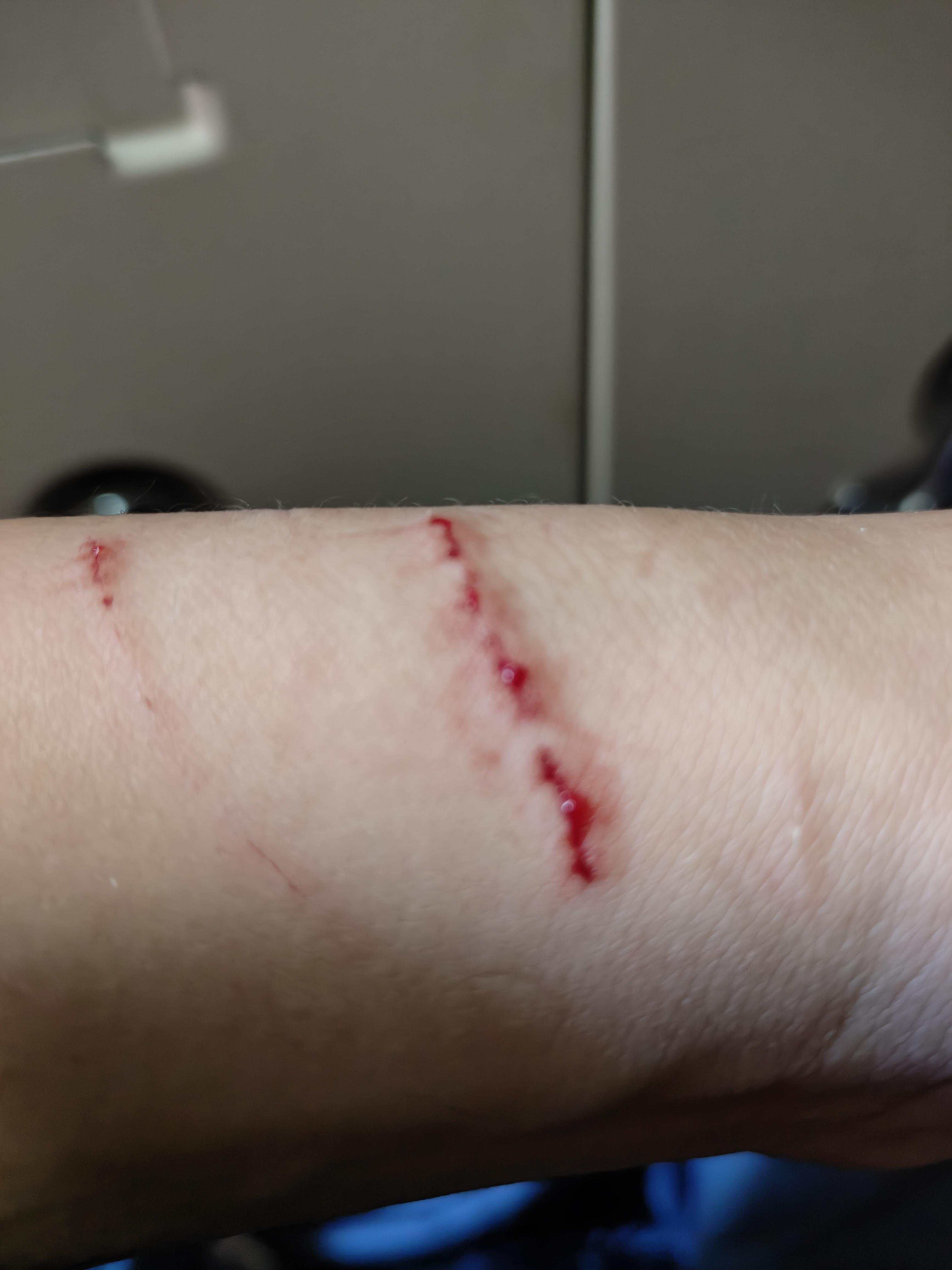 焦莺 的想法: 被猫抓了