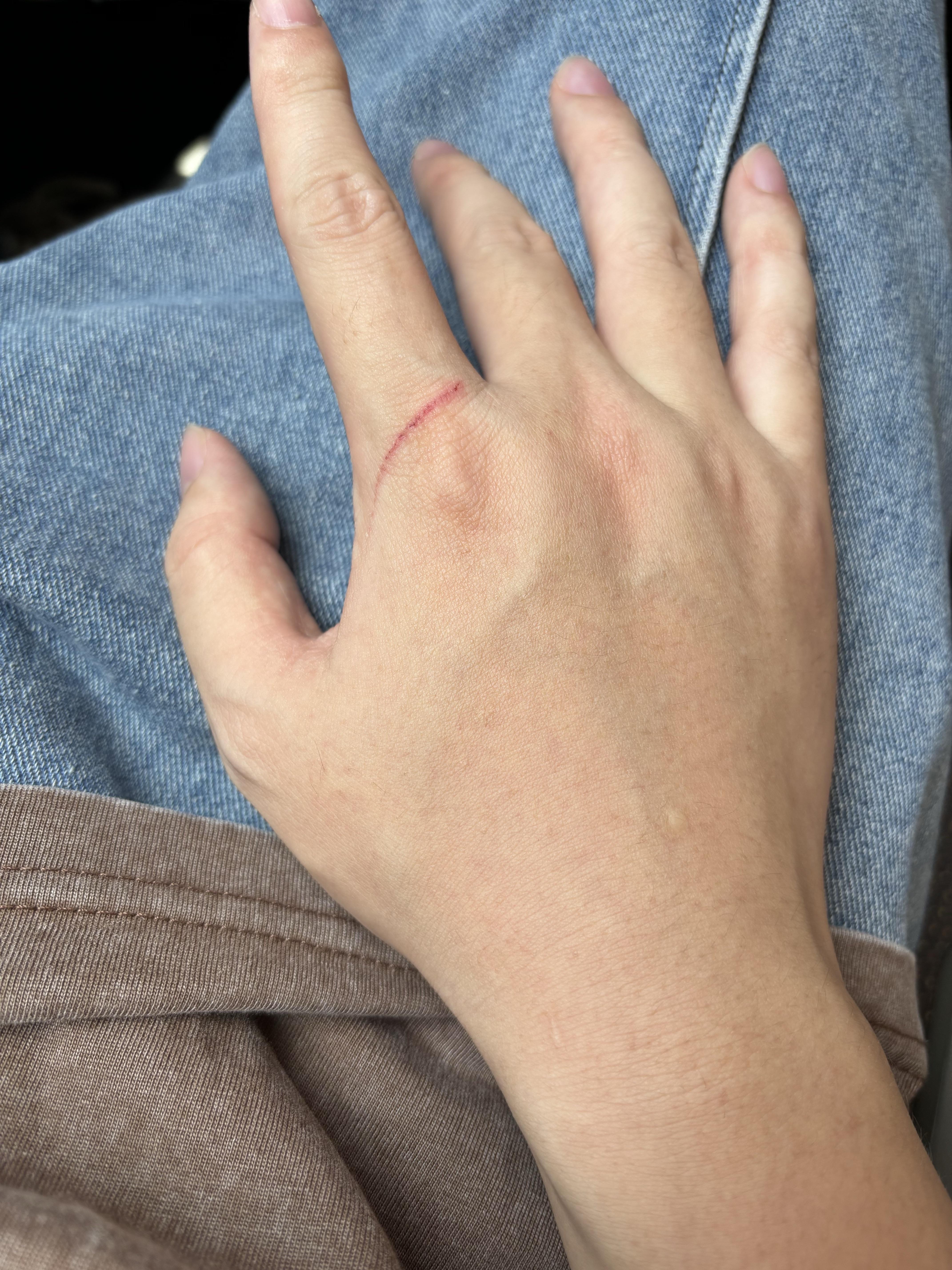 时空过敏株 的想法: 今天参加事业单位统考,考前被猫挠了