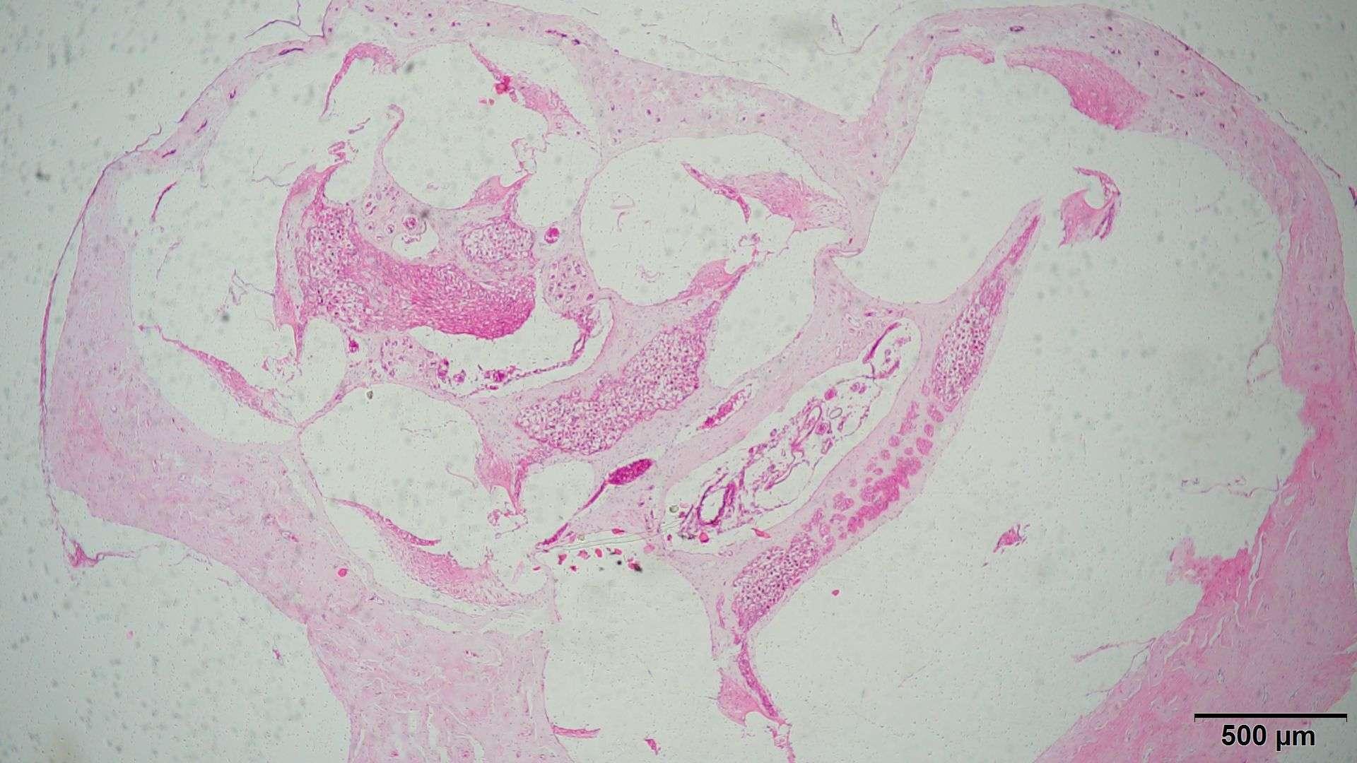 我这个耳蜗切片为什么找不到前庭膜和蜗管结构啊