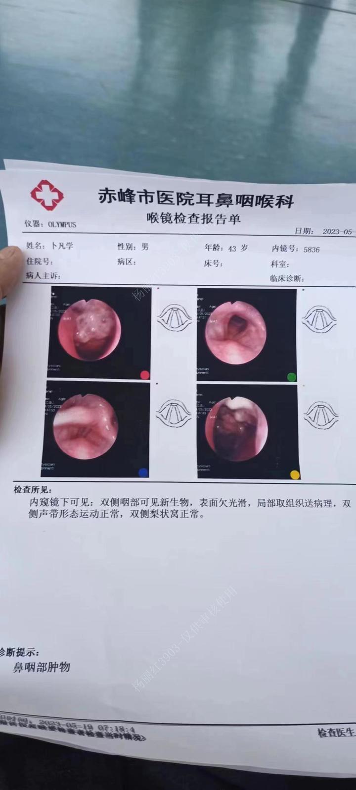 爱心接力 的想法: 赤峰急救,卜凡学患有鼻咽癌,恳请大家帮助