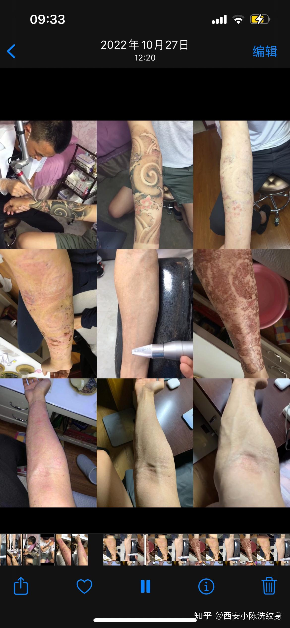西安小陈洗纹身 - 知乎