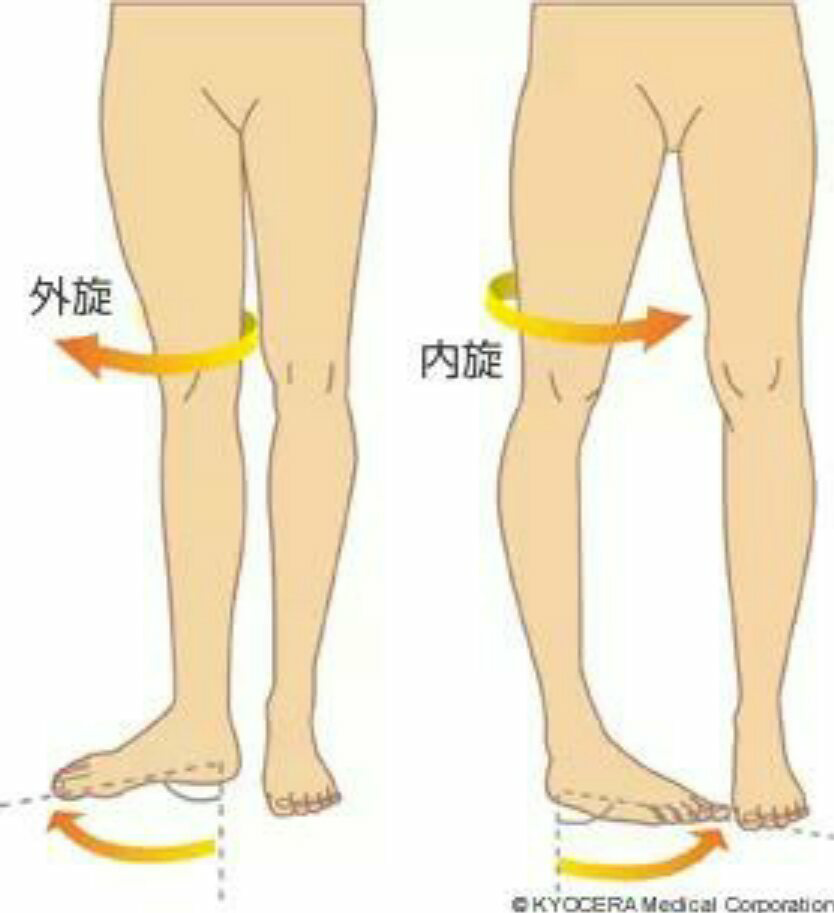 髋关节外旋以及个人的矫正方法