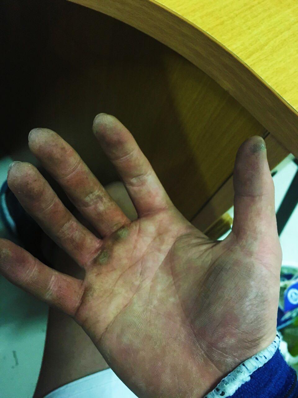 手上有茧给人怎样的感受