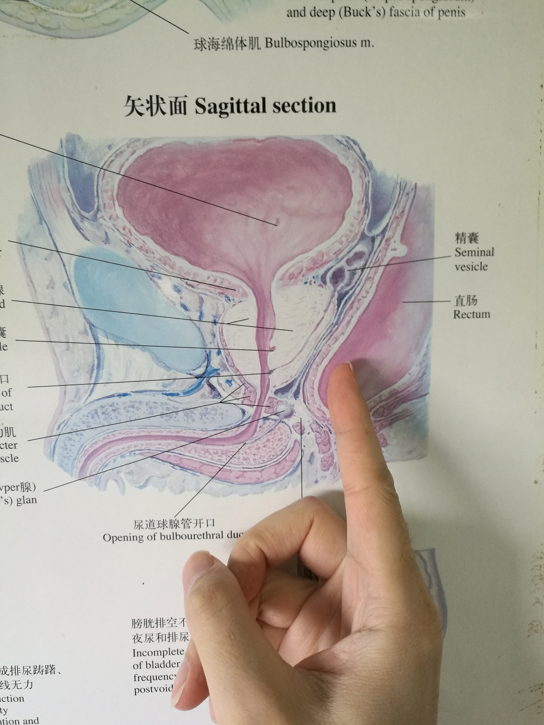 前列腺液怎么取出来图片