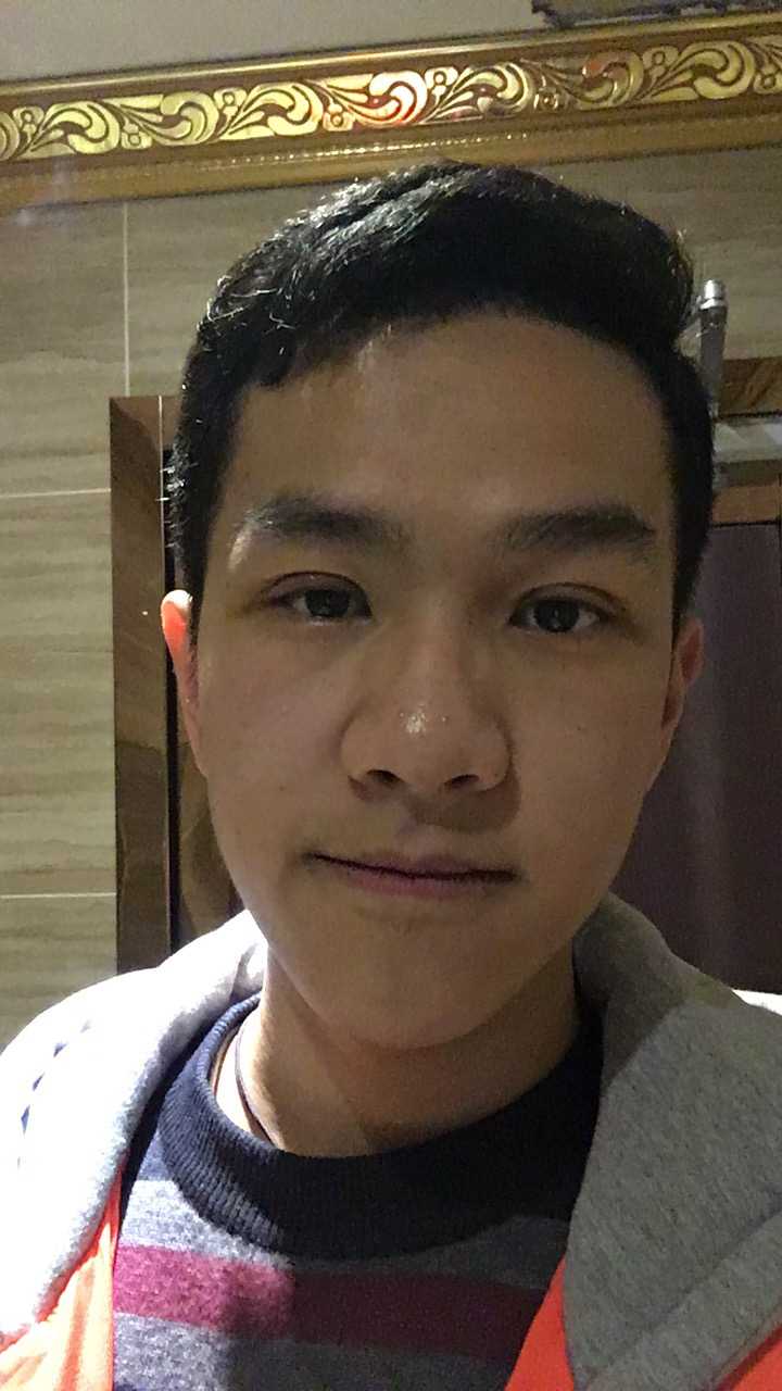 双眼皮的价格_郑大一附院割双眼皮价格_全切双眼皮价格