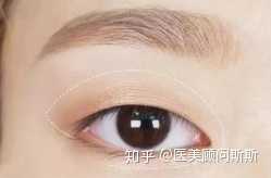 内双到底是那样的,和双眼皮以及单眼皮有什么大的区别? - 知乎