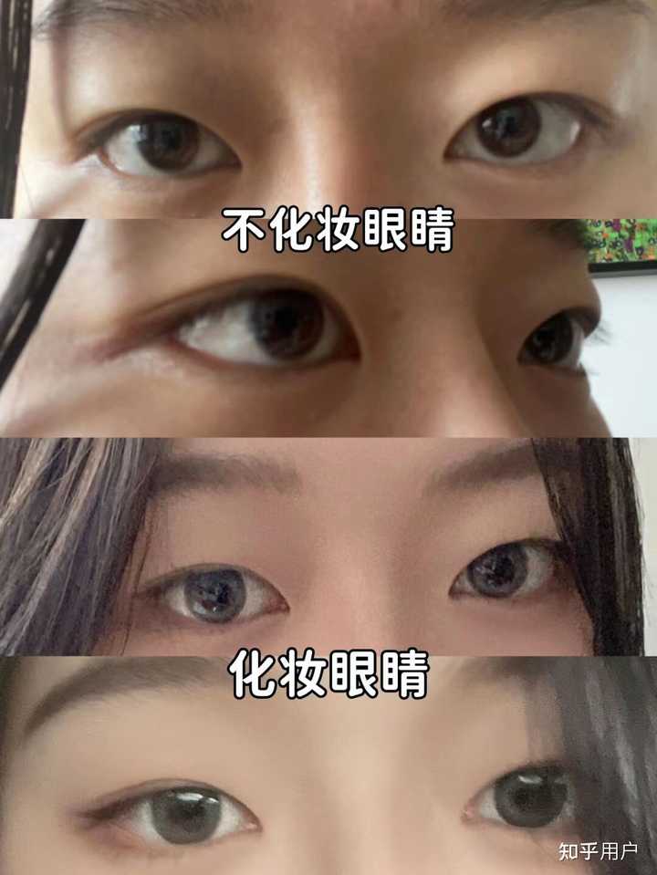 埋线法双眼皮价格_双眼皮埋线价格_双眼皮法埋线价格多少