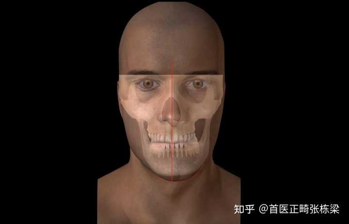 偏颌是怎样一种体验? - 知乎