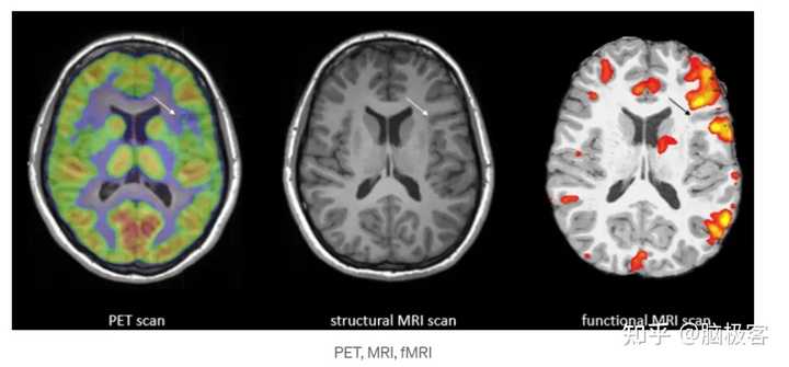 请问一个完整的处理fMRI数据的流程是怎样的？ - 知乎