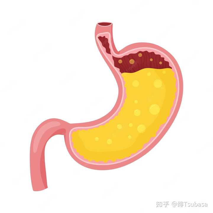 胃液中含有哪些消化酶? - 知乎
