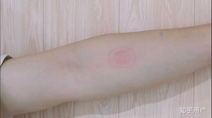 脖子上的哪些位置可以种草莓（吻痕）？ - 知乎