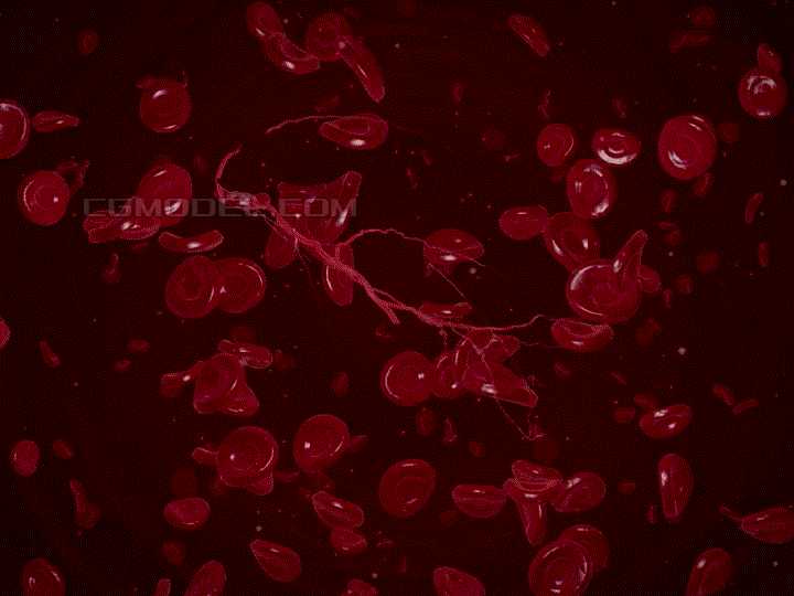 血栓分为四种那么白色红色混合血栓都在身体哪些部位或是怎么形成的