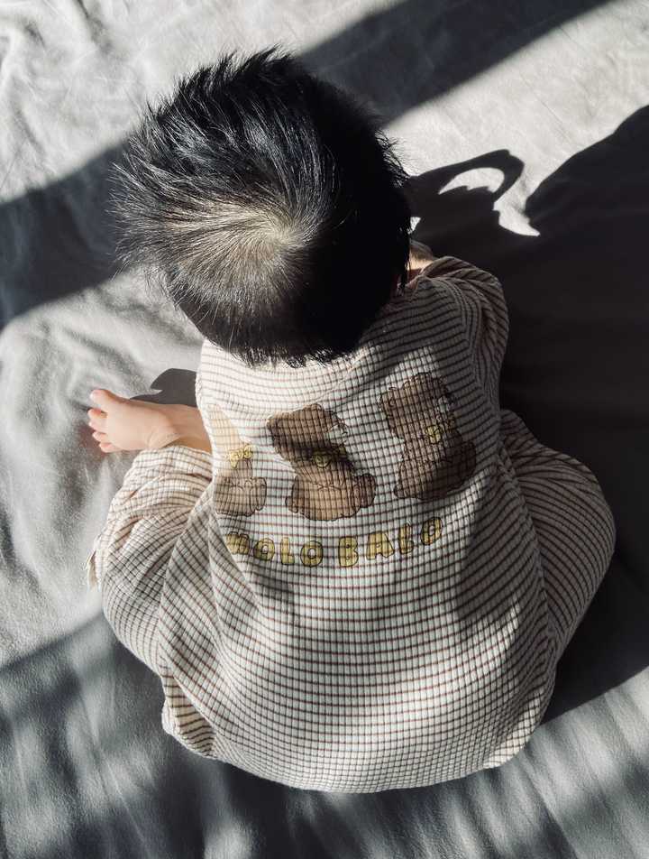 宝宝枕秃如何处理? - 知乎
