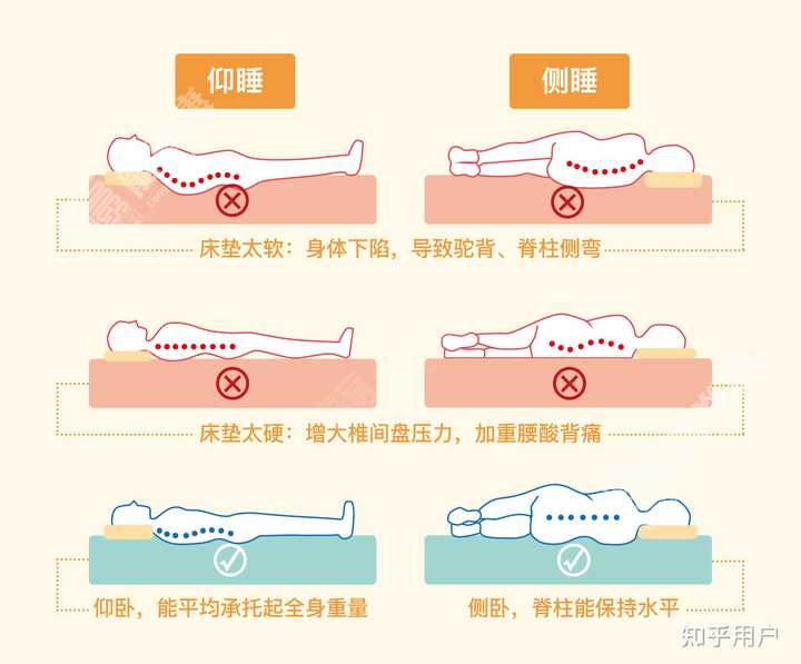 如何纠正自己的不良睡姿? - 知乎