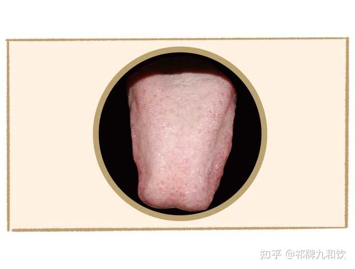 你对中医舌象怎么看,它准确吗? - 知乎