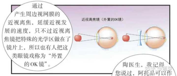 离焦镜是什么原理,真的可以缓解近视吗? - 知乎