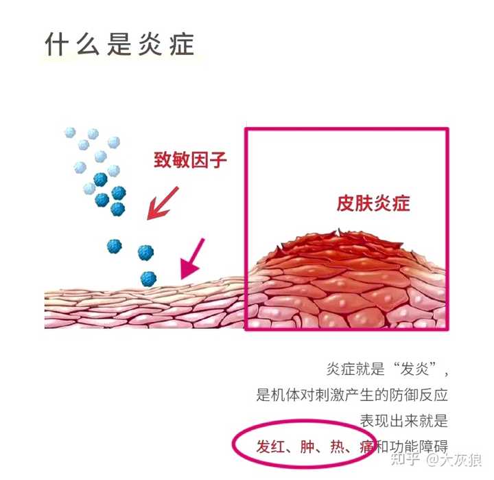 导致皮肤发炎的主要原因有哪些? - 知乎