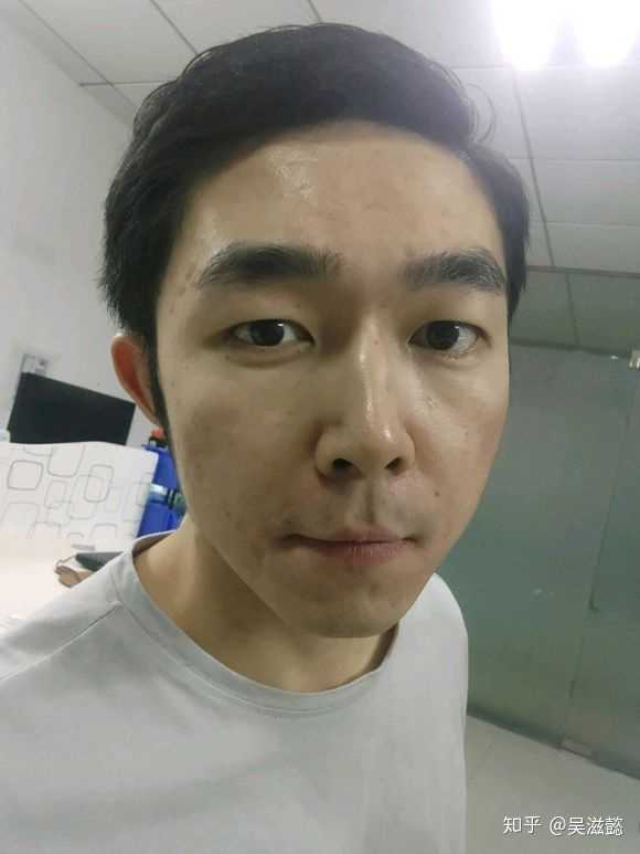 撸管可以减少青春痘的爆发吗?