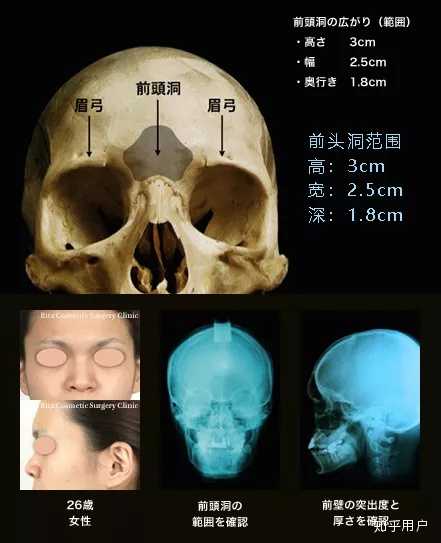 什么样的眉骨好看? - 知乎