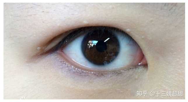 内双到底是那样的,和双眼皮以及单眼皮有什么大的区别? - 知乎