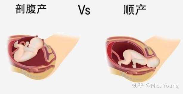 运动减肥_减肥运动计划_减肥运动的最佳时间