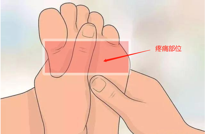 脚跟疼痛是什么原因 又该怎么缓解？ 知乎 