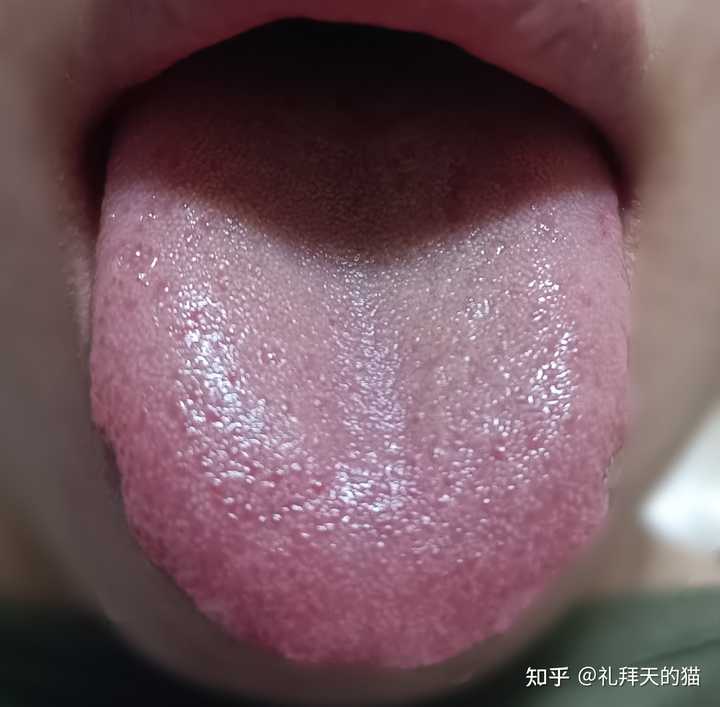 脾肾阳虚怎么调理? - 知乎