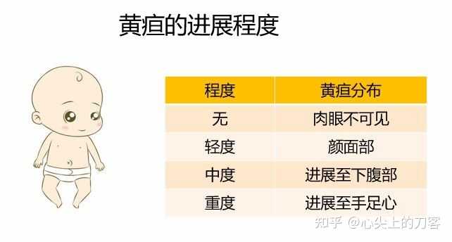 新生儿黄疸反复发作怎样处理比较合适? - 知乎