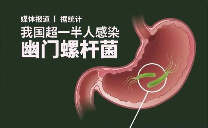 胃炎里常说的幽门螺杆菌是什么? - 知乎