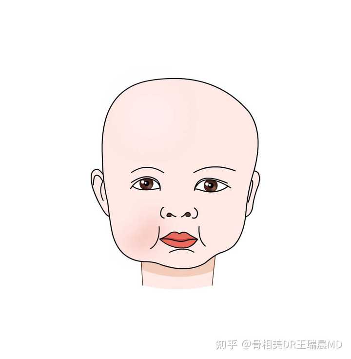 大小脸嘴歪应该看什么科？