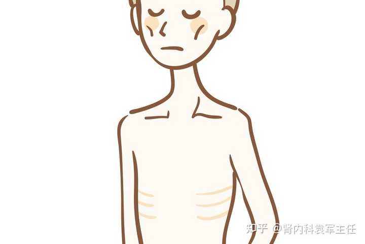 糖尿病人三多一少的机制是什么? - 知乎