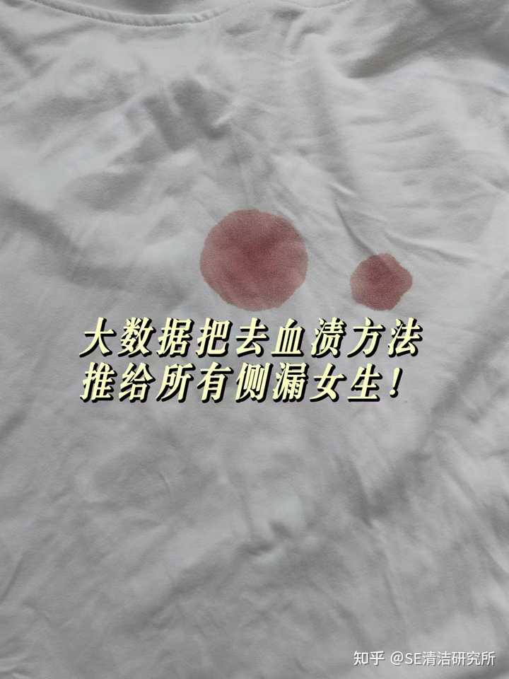 衣服上的血渍怎么洗掉? - 知乎