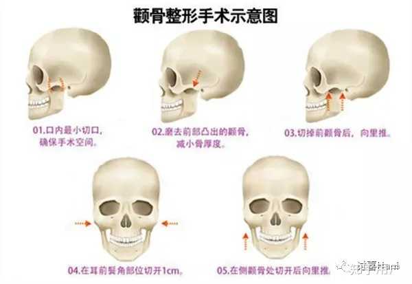 如何判断一个人的颧骨是高还是低？ - 知乎