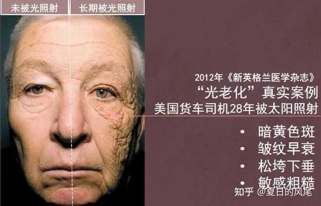 光老化是导致皮肤衰老的主要原因吗？不涂防晒皮肤会老的很快吗？ - 知乎