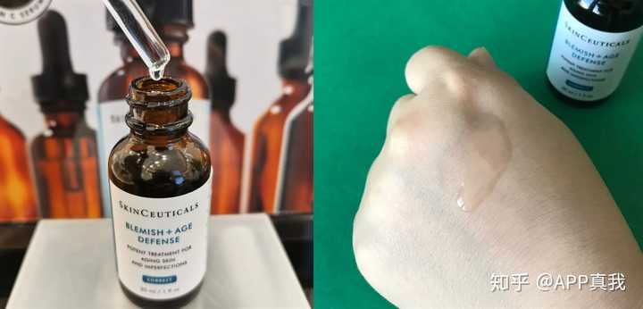 痘印心得经验_痘印心得经验_痘印心得经验