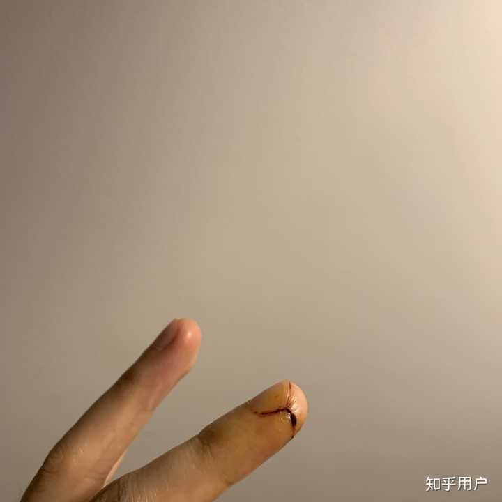 平时手指被割伤应该怎么处理? - 知乎