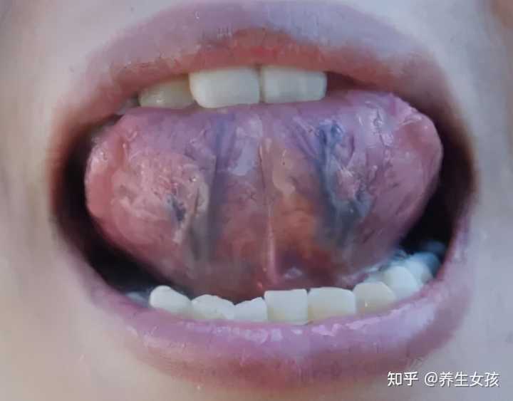 嘴唇的颜色和身体健康有关系吗 知乎