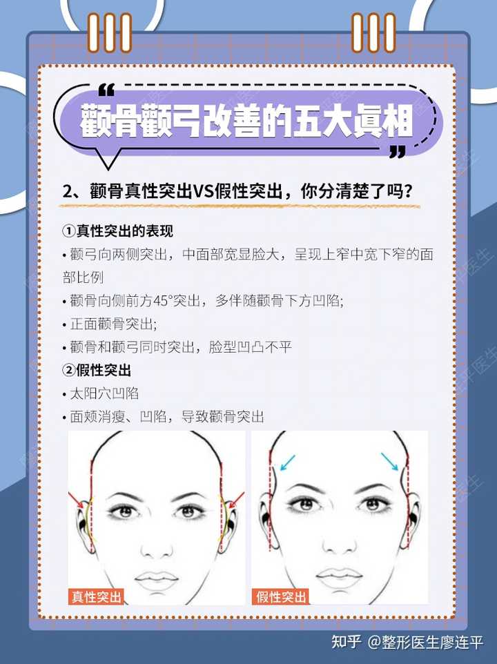 关于颧骨颧弓的五大真相,你知道吗? - 知乎
