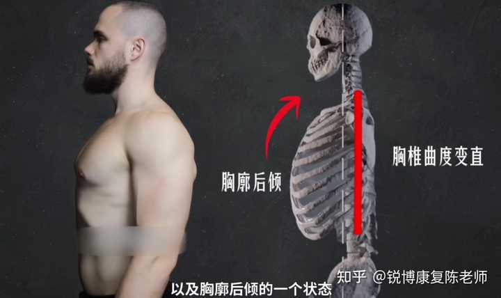 肱骨前移如何调整，需要多久？ - 知乎