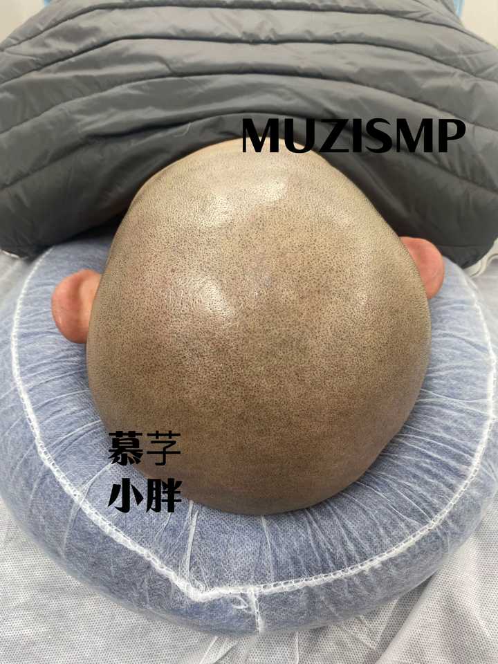 男生光头是种什么体验? - 知乎