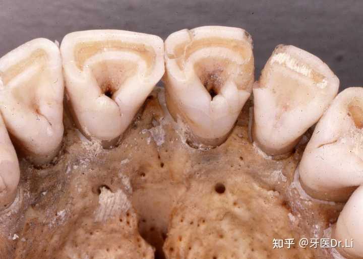 黄种人如果来自寒带，为什么会进化出铲型门牙？ - 知乎
