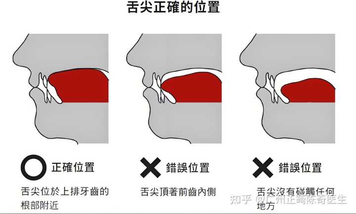 舌头的正确安放位置? - 知乎