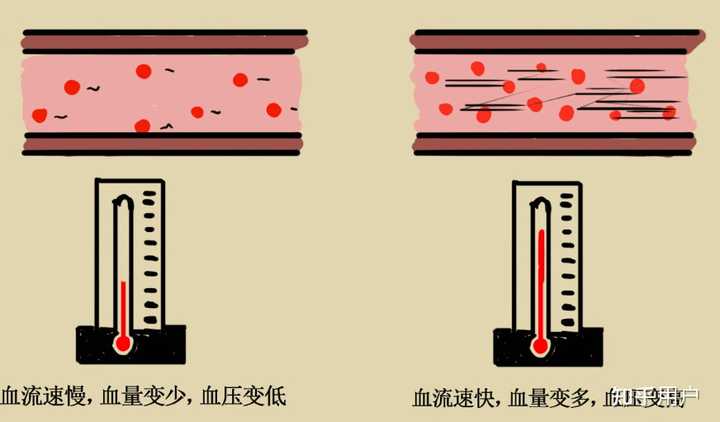 高血压的发生原理是什么? - 知乎