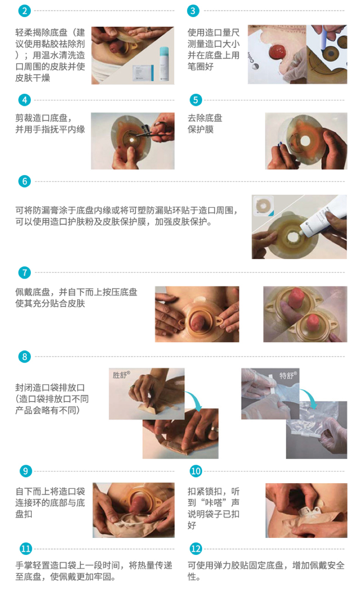 造口人应该怎么生活？ - 知乎