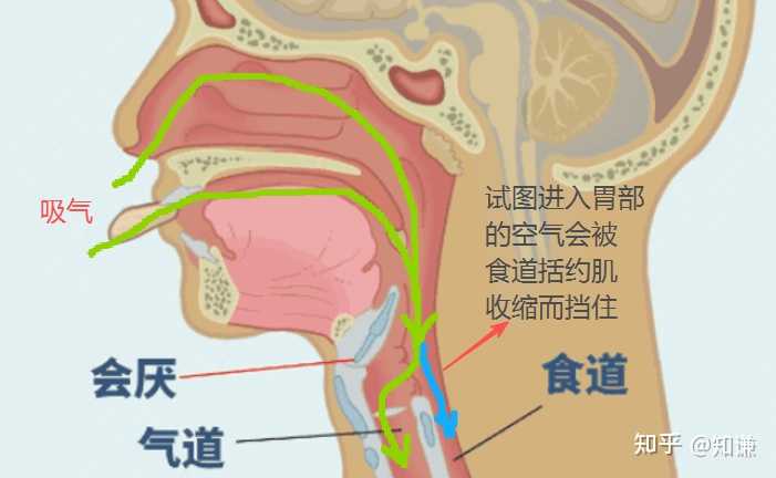 男子从喉咙痛到进 ICU 只用 1 小时,患急性重症会厌脓肿,什么是会厌脓肿?冬季喉咙痛要注意什么? - 知乎